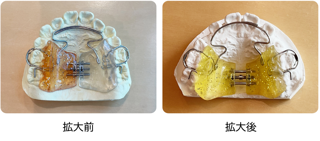 バイオブロック